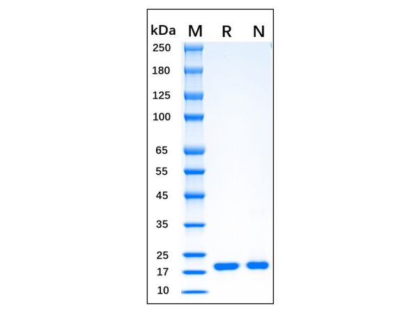 aladdin 阿拉丁 rp145913 Recombinant Human FGF10 Protein Animal Free, >95% SDS-PAGE, Active, E.coli, No tag, Leu40-Ser208