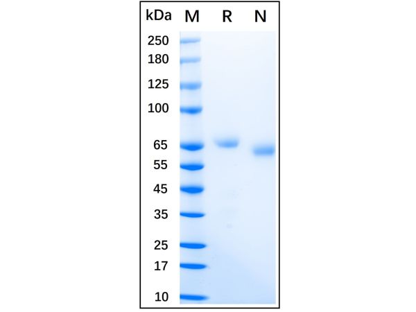 aladdin 阿拉丁 rp147384 Recombinant Human IL-12 Protein Animal Free, > 95% (SDS-PAGE), Active, CHO, No tag,  Human IL-12 p40 (Ile23-Ser328) & Human IL-12 p35 (Arg23-Ser219)