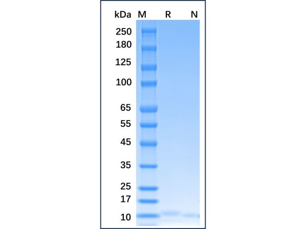 aladdin 阿拉丁 rp147404 Recombinant Human IL-15 Protein Animal Free, >97% (SDS-PAGE), Active, E. coli., No tag, 49-162 aa