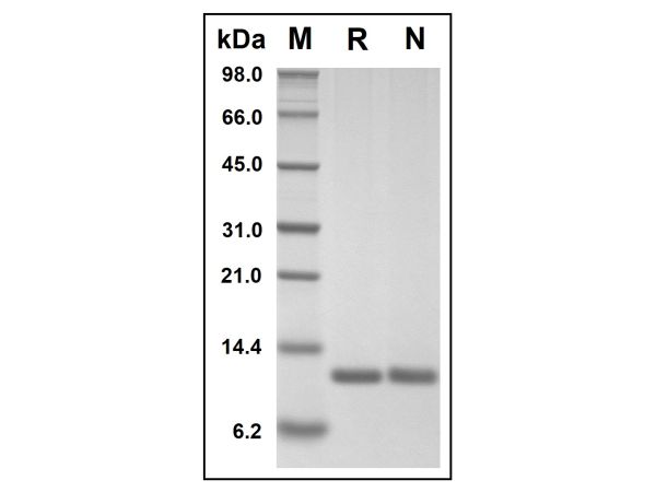 aladdin 阿拉丁 rp148808 Recombinant Human MIF Protein Animal Free, ≥95%(SDS-PAGE), Active, E.coli, No tag, 1-115 aa