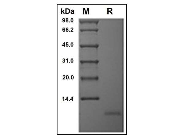 aladdin 阿拉丁 rp149203 Recombinant Human Neuritin Protein Animal Free, >97%( SDS-PAGE and HPLC), Active, E.coli, No tag, 28-115 aa