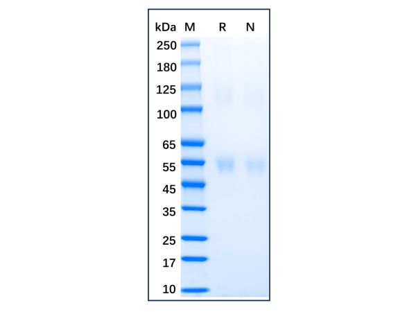 aladdin 阿拉丁 rp150291 Recombinant Human PLA2G7 Protein Animal Free, >90% (SDS-PAGE), Active, HEK293, C-His tag, 22-441 aa