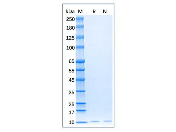 aladdin 阿拉丁 rp151342 Recombinant Human SDF1 Protein Animal Free, >95% SDS-PAGE, Active, E.coli, His, Pro23~Lys89