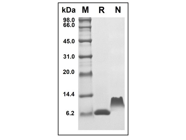 aladdin 阿拉丁 rp152075 Recombinant Human TARC/CCL17 Protein Animal Free, >97% (SDS-PAGE and HPLC), Active, E. coli, No tag, 24-94 aa