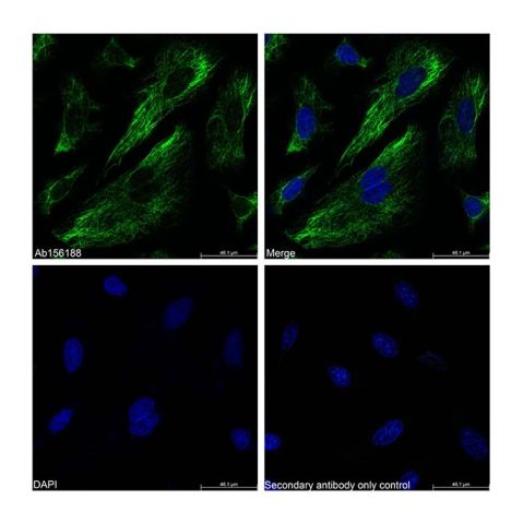 aladdin 阿拉丁 Ab156188 Vimentin Mouse mAb mAb (AB10/4F11); Mouse anti Vimentin Antibody; WB, Flow, ICC/IF, ELISA; Unconjugated