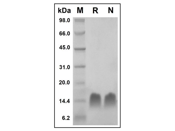 aladdin 阿拉丁 rp152337 Recombinant Human Thymosin beta 4 Protein Animal Free, >97%(SDS-PAGE and HPLC), Active, E.coli, No tag, 2-44 aa