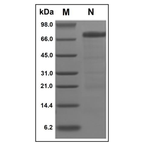 aladdin 阿拉丁 rp152533 Recombinant Human HVEM/TNFRSF14 Protein Animal Free, >95% (SDS-PAGE&HPLC), Active, Pichia Pastoris, C-Fc tag, 39-202 aa