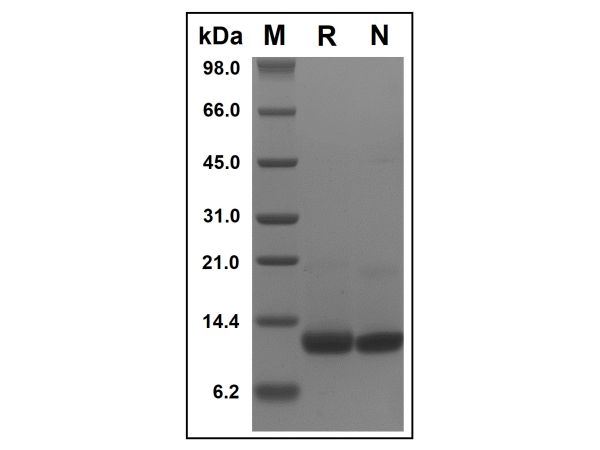 aladdin 阿拉丁 rp153852 Recombinant Mouse CXCL16 Protein Animal Free, >98%(SDS-PAGE, HPLC), Active, E.coli, No tag, 27-114 aa