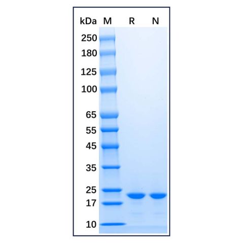 aladdin 阿拉丁 rp153970 Recombinant Mouse FGF-21 Protein Animal Free, >96%(SDS-PAGE, HPLC), Active, E.coli, No tag, 29-210 aa