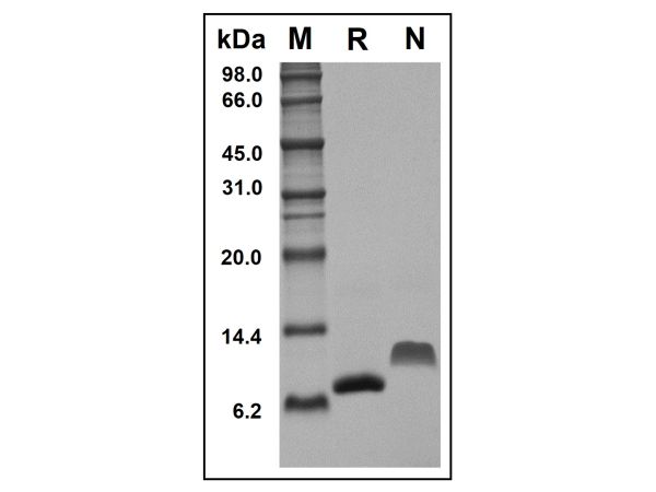 aladdin 阿拉丁 rp154359 Recombinant Mouse MCP2 Protein Animal Free, >97%(SDS-PAGE and HPLC), Active, E.coli, No tag, 24-97 aa