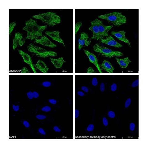 aladdin 阿拉丁 rp155876 Streptavidin protein (FITC) Streptavidin was conjugated with FITC under optimum conditions, and unconjugated Streptavidin and free FITC were removed.