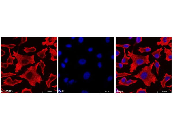 aladdin 阿拉丁 Ab156253 Goat Anti-Mouse IgG H&L (Biotin) Secondary Antibody; Goat Anti-Mouse IgG H&L (Biotin); WB, ELISA, IF, Flow