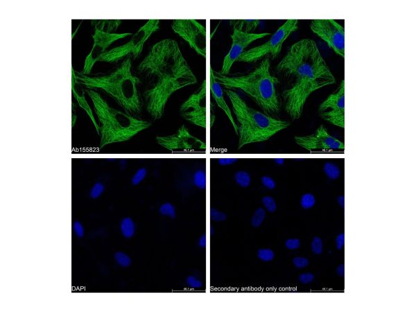 aladdin 阿拉丁 Ab156254 Goat Anti-Mouse IgG H&L (FITC) Secondary Antibody; Goat Anti-Mouse IgG H&L (FITC); IF, Flow