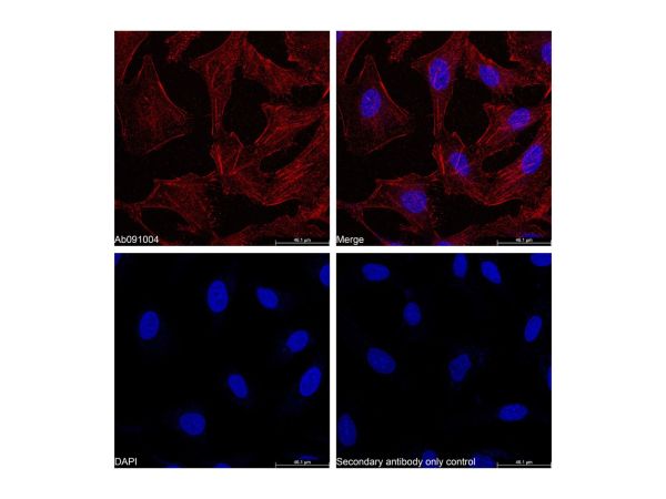 aladdin 阿拉丁 Ab170143 Goat Anti-Rabbit IgG H&L (Biotin) Secondary Antibody; Goat Anti-Rabbit IgG H&L (Biotin); WB, ELISA, IF