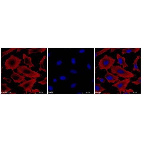 aladdin 阿拉丁 Ab176323 beta Actin Mouse mAb (TRITC) mAb (FG01/2D10); Mouse anti Human beta actin Antibody; IF; TRITC