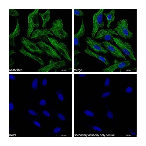 aladdin 阿拉丁 Ab179003 Goat Anti-Mouse IgG H&L (FITC) Secondary Antibody; Goat Anti-Mouse IgG H&L (FITC); IF, Flow