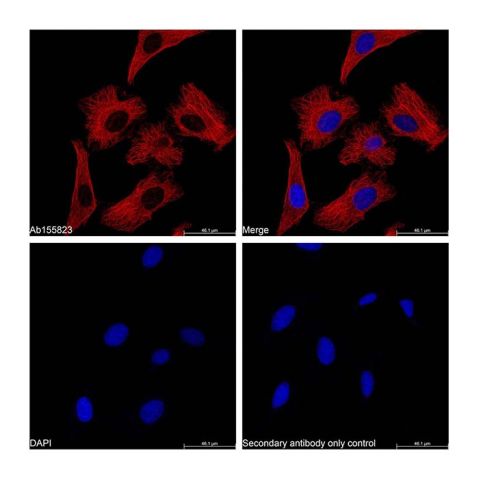 aladdin 阿拉丁 Ab179004 Goat Anti-Mouse IgG H&L (Cy5) Secondary Antibody; Goat Anti-Mouse IgG H&L (Cy5); IF, Flow