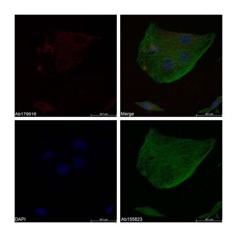 aladdin 阿拉丁 Ab179916 BrdU Mouse mAb mAb (AB03/1C6); Mouse anti BrdU Antibody; Flow, ICC/IF, ELISA; Unconjugated