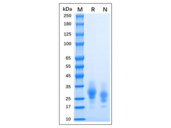 aladdin 阿拉丁 rp155933 Recombinant MPXV A30L Protein Animal Free, >95% (SDS-PAGE), 293 cell, C-His tag, 26-146 aa