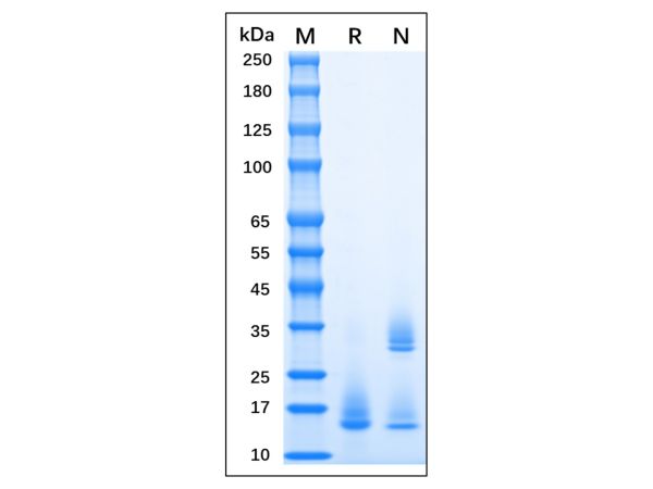 aladdin 阿拉丁 rp155934 Recombinant MPXV A35R Protein Animal Free, >95% (SDS-PAGE), 293 cell, C-His tag, 58-181 aa