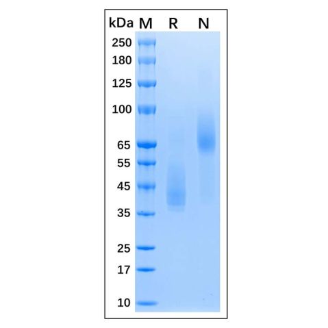 aladdin 阿拉丁 rp155937 Recombinant MPXV E8L Protein Animal Free, >95% (SDS-PAGE), 293F cell, His tag, 1-275 aa