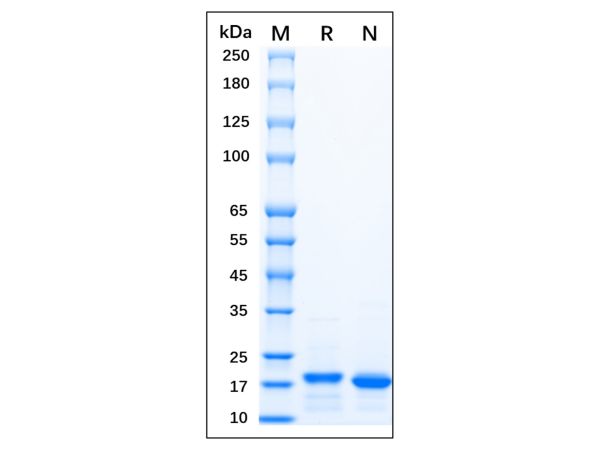 aladdin 阿拉丁 rp156342 Recombinant Human KGF/FGF-7 Protein Carrier Free, >90% (SDS-PAGE), E.coli, No tag, 32-194 aa