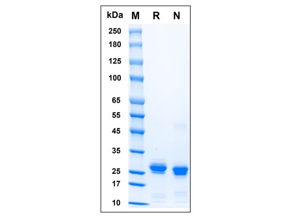 aladdin 阿拉丁 rp156653 Recombinant Human HMGB1 Protein Carrier free, >90% (SDS-PAGE), E.coli, N-His tag, 1-215 aa