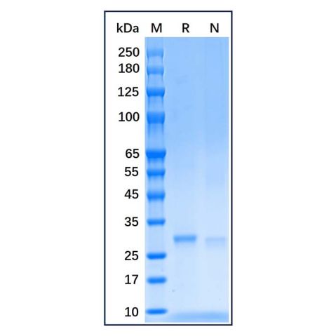 aladdin 阿拉丁 rp156670 Recombinant Human SDHB Protein Carrier Free, >90% (SDS-PAGE), E.coli, His tag, 29-280 aa