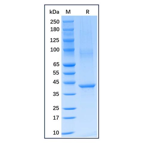 aladdin 阿拉丁 rp156680 Recombinant Human Aurora B Protein Carrier Free, >90% SDS-PAGE, E.coli, N-His, 1-344 aa