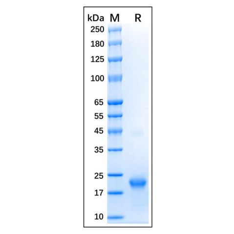 aladdin 阿拉丁 rp170121 Recombinant Human GTPase HRAS Protein Carrier Free, >95% (SDS-PAGE), E.coli, His tag, 2-186 aa