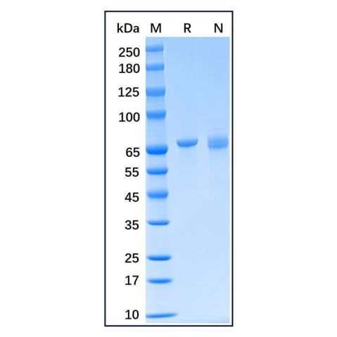 aladdin 阿拉丁 rp170125 Recombinant Human Grp75/MOT Protein Carrier Free, >95% SDS-PAGE, E.coli, N-His tag, 47-679 aa