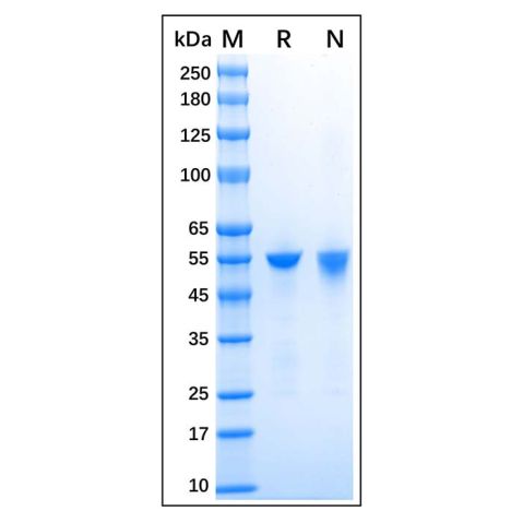 aladdin 阿拉丁 rp175922 Recombinant Human ALDH1A1 Protein Carrier Free, >95% (SDS-PAGE), E.coli, His tag, 2-501 aa