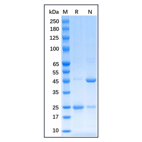 aladdin 阿拉丁 rp175926 Recombinant Human Estrogen Receptor alpha Protein Carrier Free, >90% (SDS-PAGE), E.coli, His tag, 1-185 aa