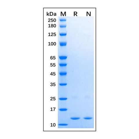 aladdin 阿拉丁 rp175932 Recombinant Human SAA1 Protein Carrier Free, >90% (SDS-PAGE), E.coli, His tag, 19-122 aa