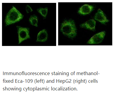 Cytokeratin (Pan)