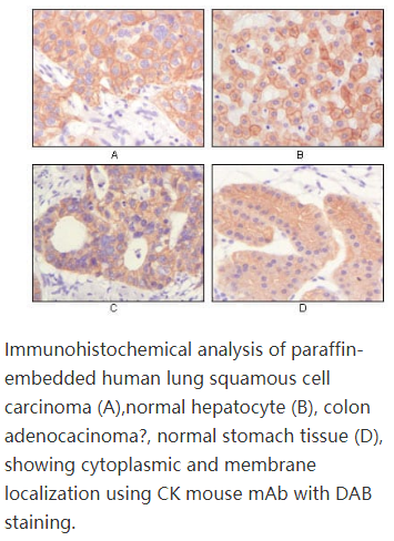 Cytokeratin (Pan)