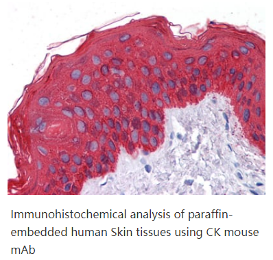 Cytokeratin (Pan)