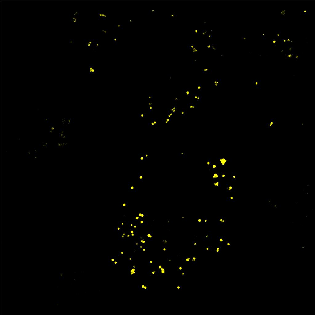 AIE脂滴黄色探针/活细胞染色/聚集诱导发光特性/无需清洗一步成像/多次成像