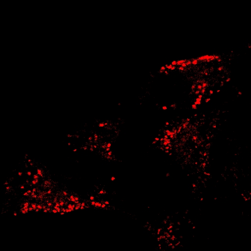 AIE脂滴红色探针/活细胞染色/聚集诱导发光特性/无需清洗一步成像/多次成像
