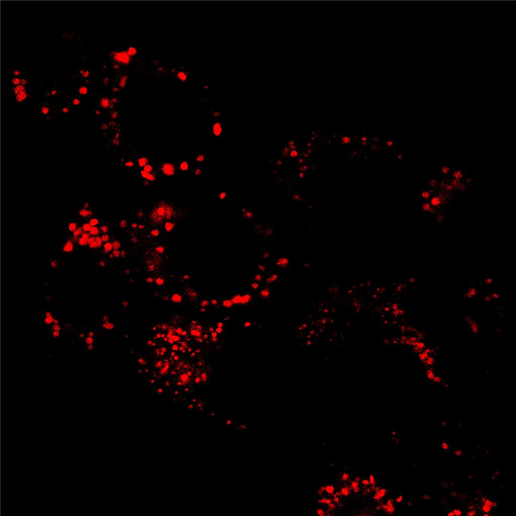AIE溶酶体红色探针/活细胞染色/聚集诱导发光特性/无需清洗一步成像/多次成像