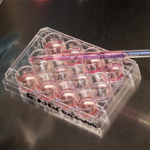 PIGR重组蛋白-ACROBiosystems百普赛斯