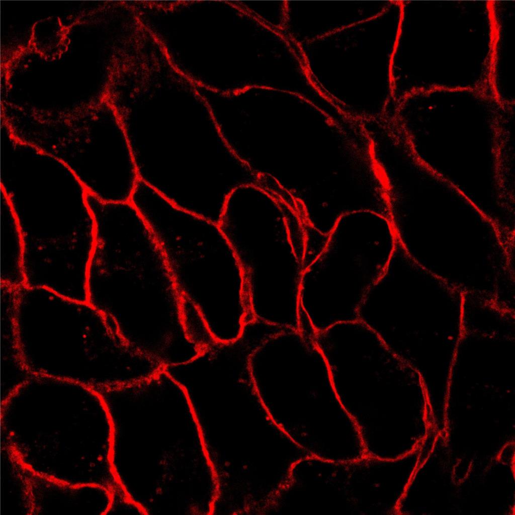 AIE细胞膜红色探针/固定细胞染色/活细胞染色/聚集诱导发光特性/多次成像探针