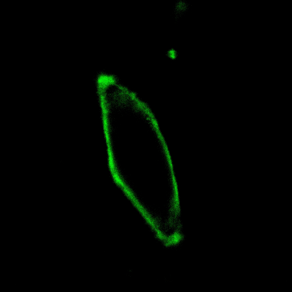 AIE细胞膜绿色探针/活细胞染色/聚集诱导发光特性/多次成像探针