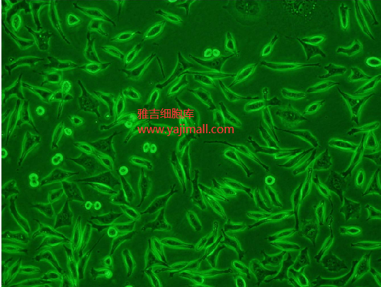 人结直肠腺癌细胞SW620/GFP