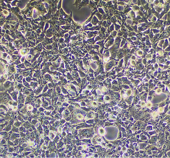 人脑髓母细胞瘤细胞D283Med