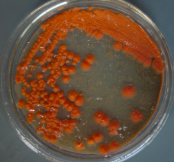 皂黏土寡养单胞菌