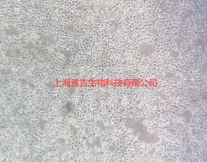 人卵巢浆液性腺癌细胞COV318