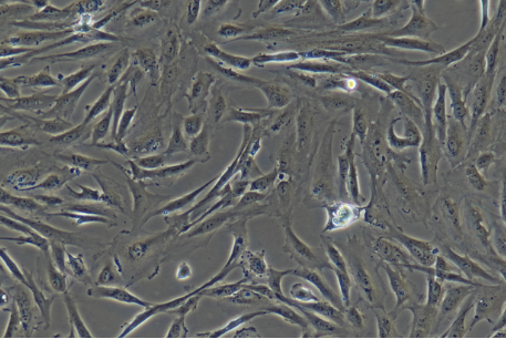 小鼠卵巢上皮癌细胞ID8