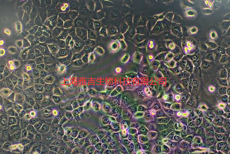 小鼠骨肉瘤成骨细胞K7M2WT(K7M2WT)/LUC