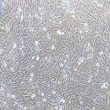 急性髓系细胞白血病细胞KG-1